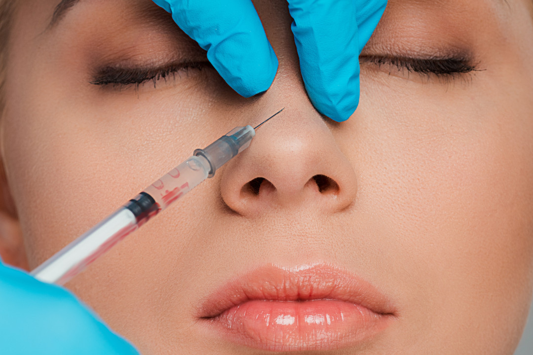 Dermal Fillers