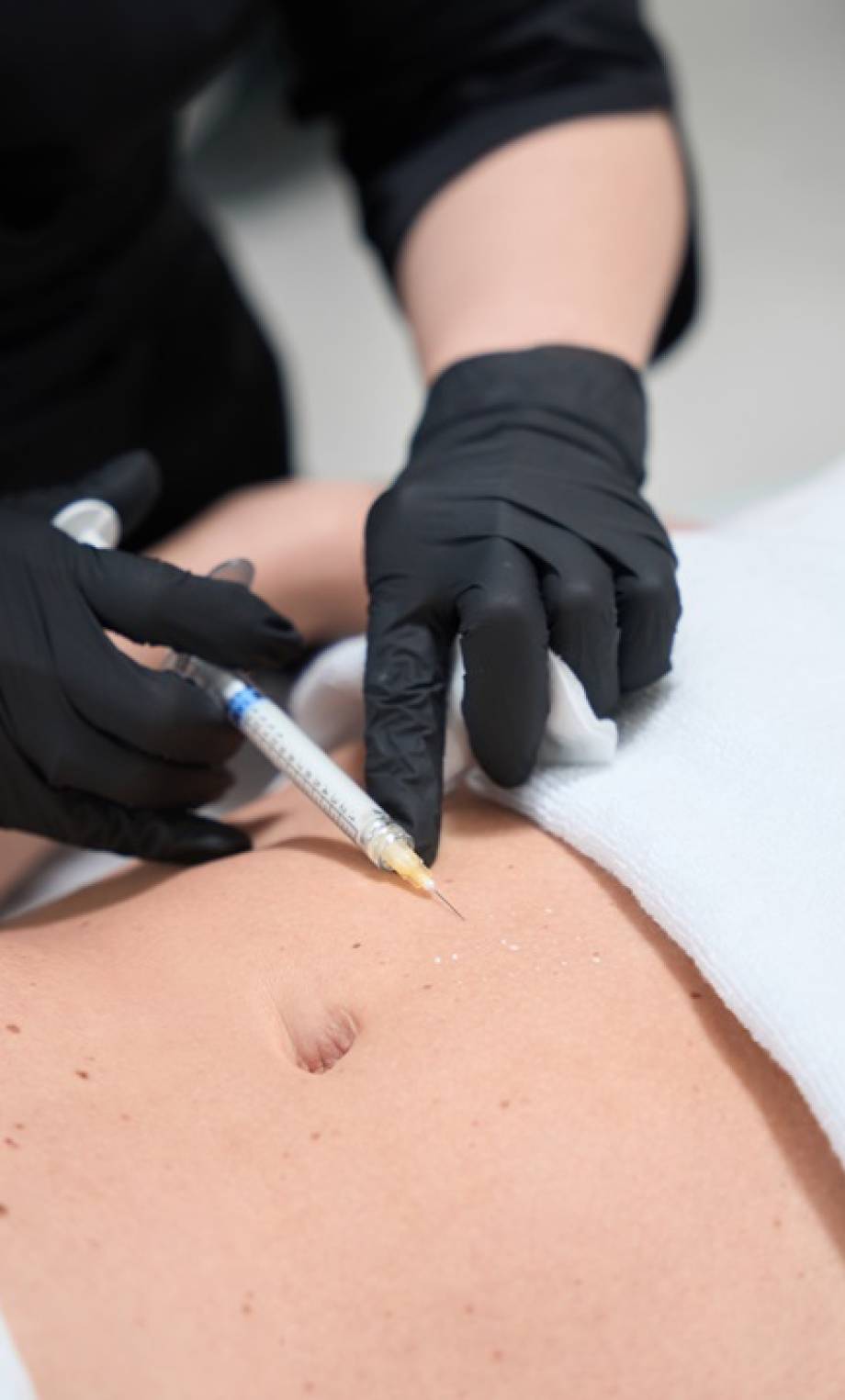 Aesthetician makes injections in the abdomen of a client in a cosmetology clinic, a specialist works in protective gloves